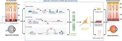 Epigenetic mechanisms of Müller glial reprogramming mediating retinal regeneration